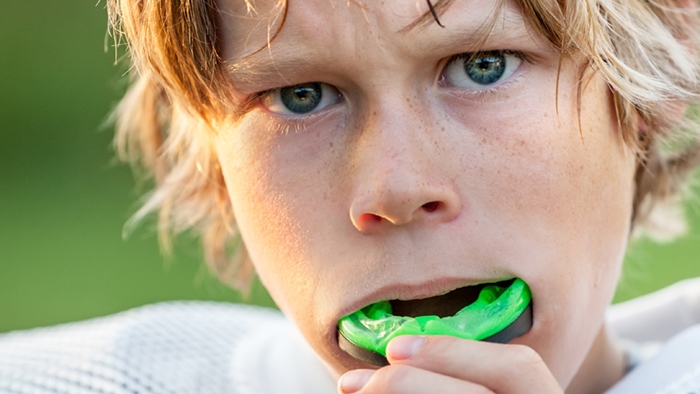 Sports Mouth Guards Dentistry Grand Rapids Dentis