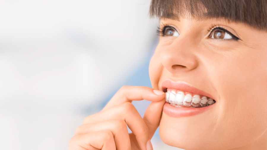 Benefits of Invisible Teeth Aligners Surrey BC - Teeth Alignment